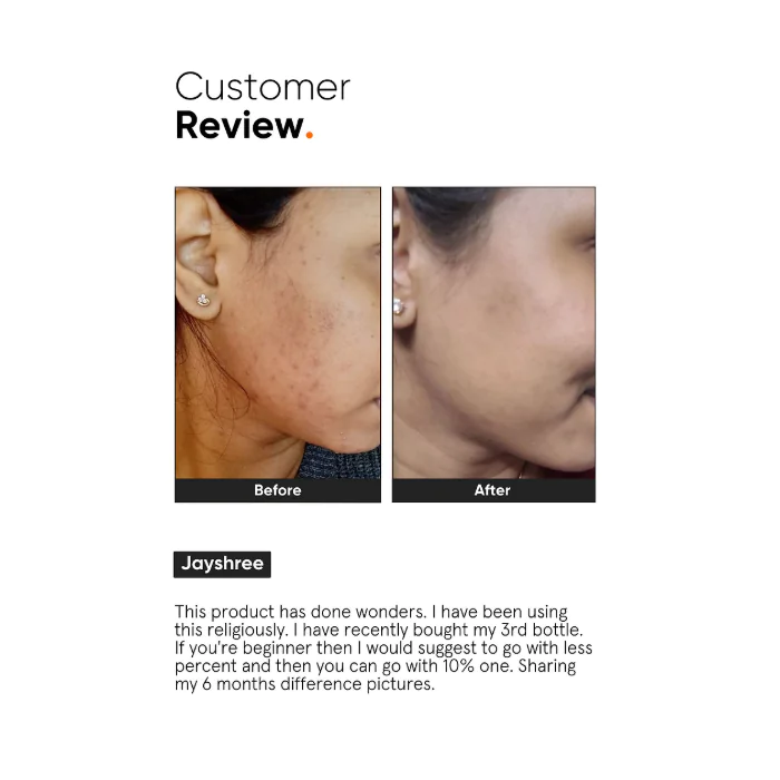 Minimalist Niacinamide 10% Face Serum