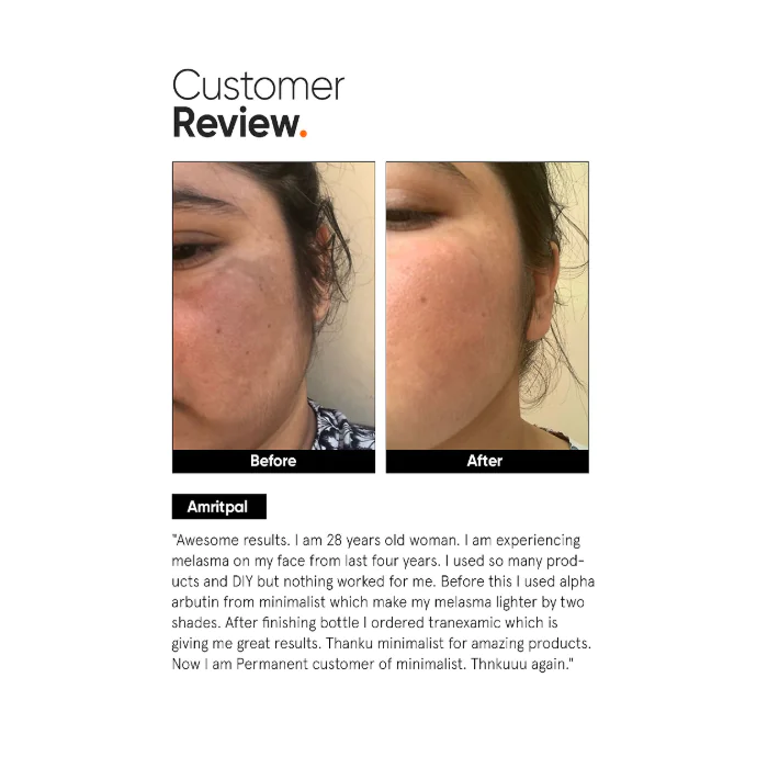 Minimalist Tranexamic 3% Face Serum