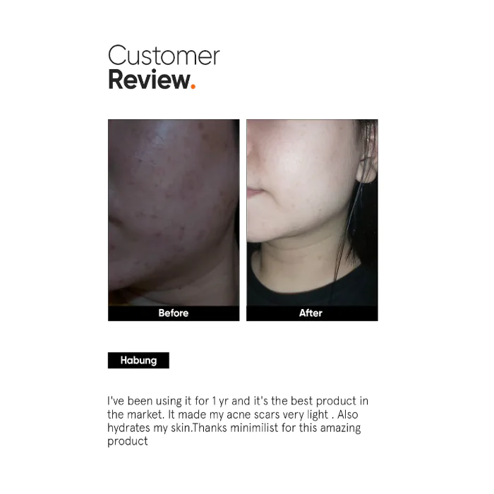 Minimalist Alpha Arbutin 2% Face Serum