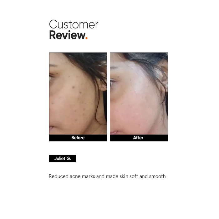 Minimalist Niacinamide 5% Face Serum