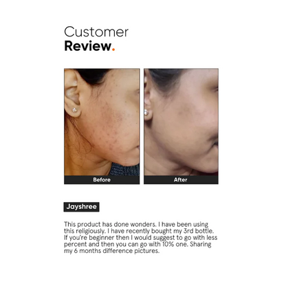 Minimalist Niacinamide 10% Face Serum